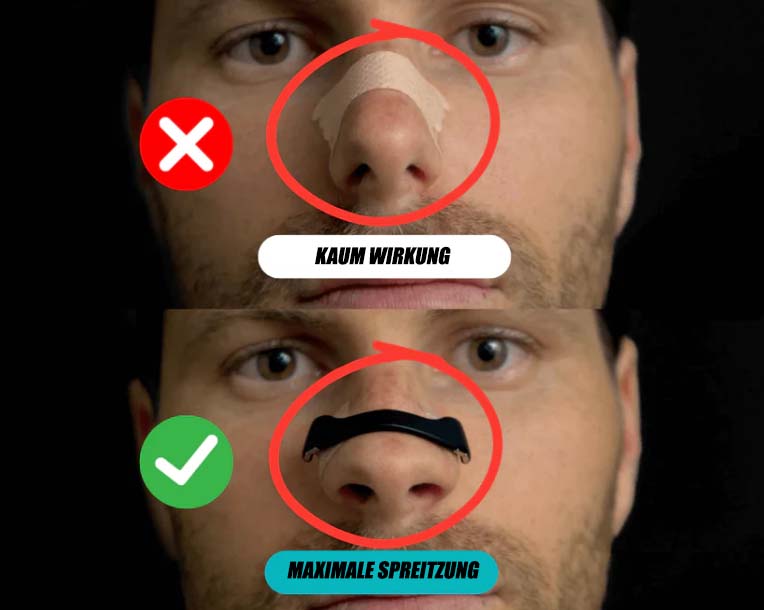 Magnetic-Nasal Strips